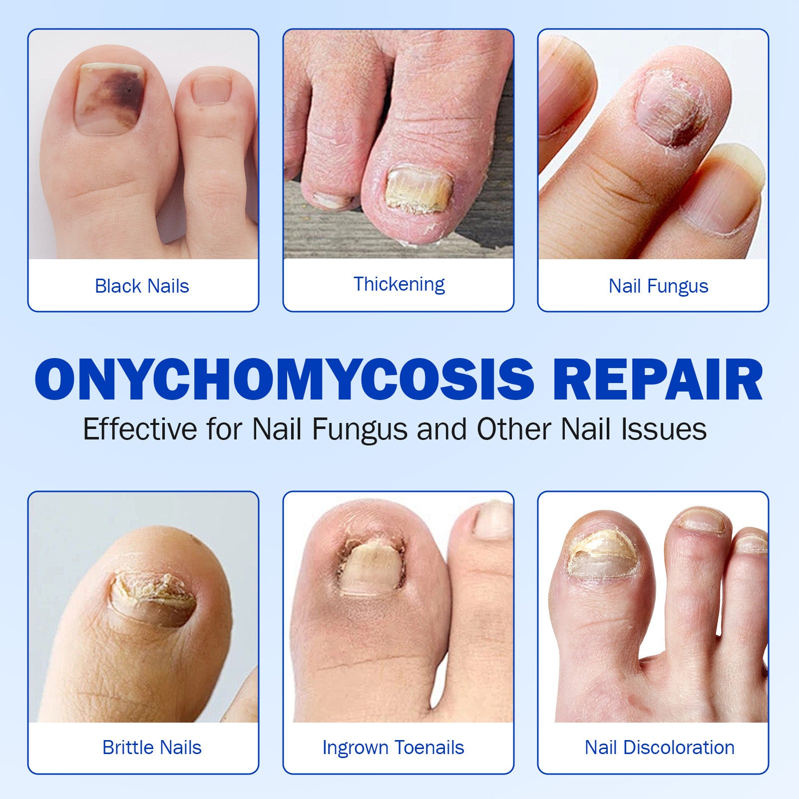 Advertisement for onychomycosis repair showing various nail issues and solutions.