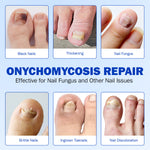 Advertisement for onychomycosis repair showing various nail issues and solutions.