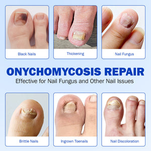 Advertisement for onychomycosis repair showing various nail issues and solutions.