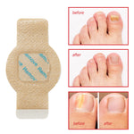 Toenail removal patch with 'before' and 'after' images of a foot.
